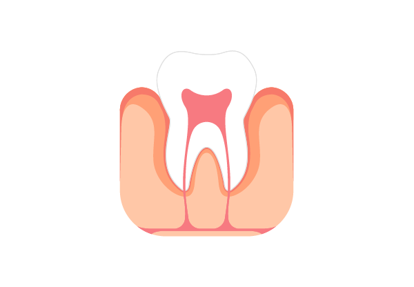 세부 조정